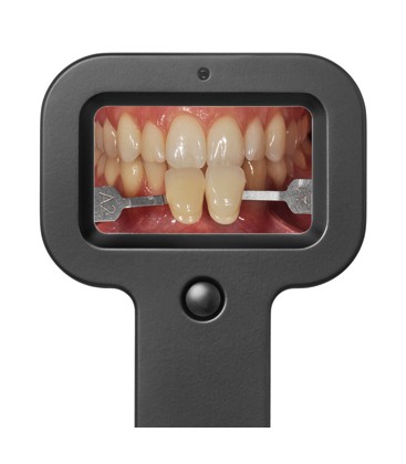 Smile Lite + Style Lense